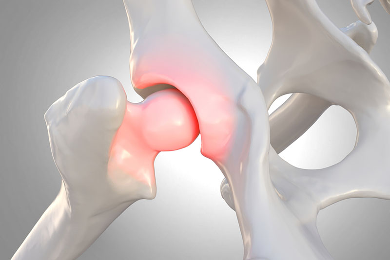 иллюстрация сустава собаки с воспалением из-за дисплазии