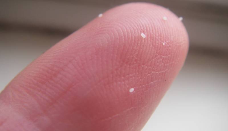 Фото яиц блохи, найденных у собаки