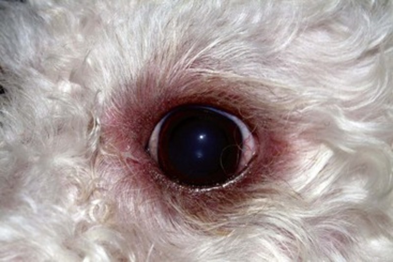 Воспаленные веки при блефарите нужно лечить специальными препаратами